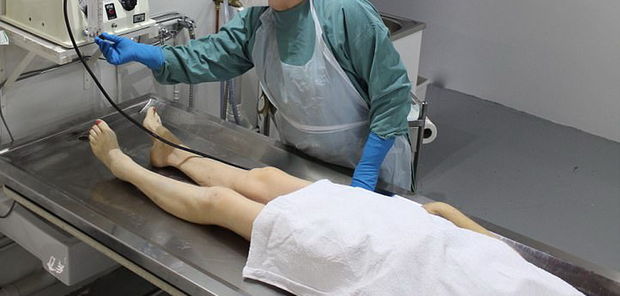 Gənc qız dəfn üçün balzamlama prosesində gözlərini açdı - FOTO