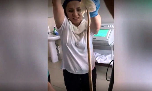 İlan yatan qadının ağzına girdi - VİDEO