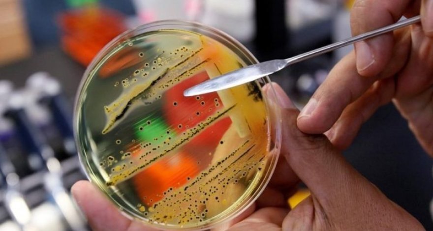 Опасную бактерию сальмонеллу нашли в необычном продукте питания