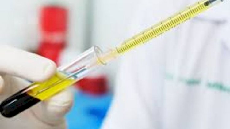 Koronavirus testləri haqda yeni təklif