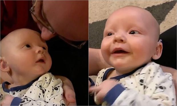 Eşitmə məhdudiyyətli uşağın ilk dəfə səs eşitdiyi anla bağlı təsirli VİDEO