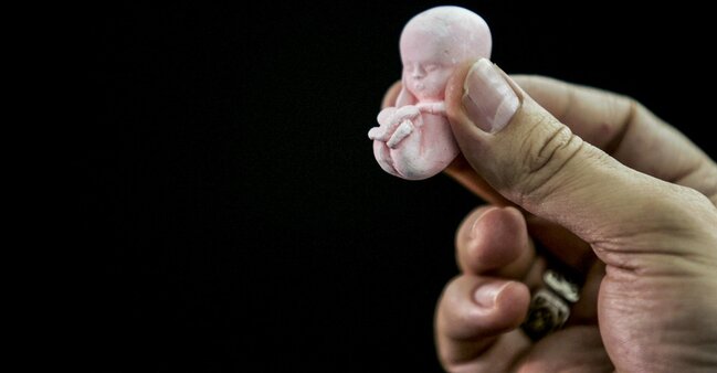 Həkimlə əlbir olub sevgilisini abort etdirdi - XAİN PLAN - VİDEO