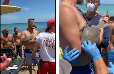 Qolunu köpəkbalığı dişləyən adam deyib-gülərək xəstəxanaya getdi - FOTO-VİDEO