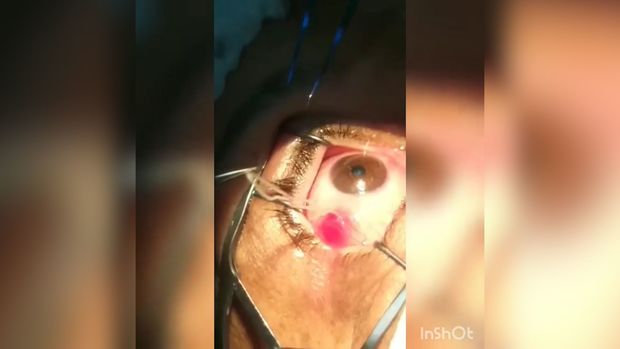 Azərbaycanda gözdən qurd çıxarıldı - VİDEO