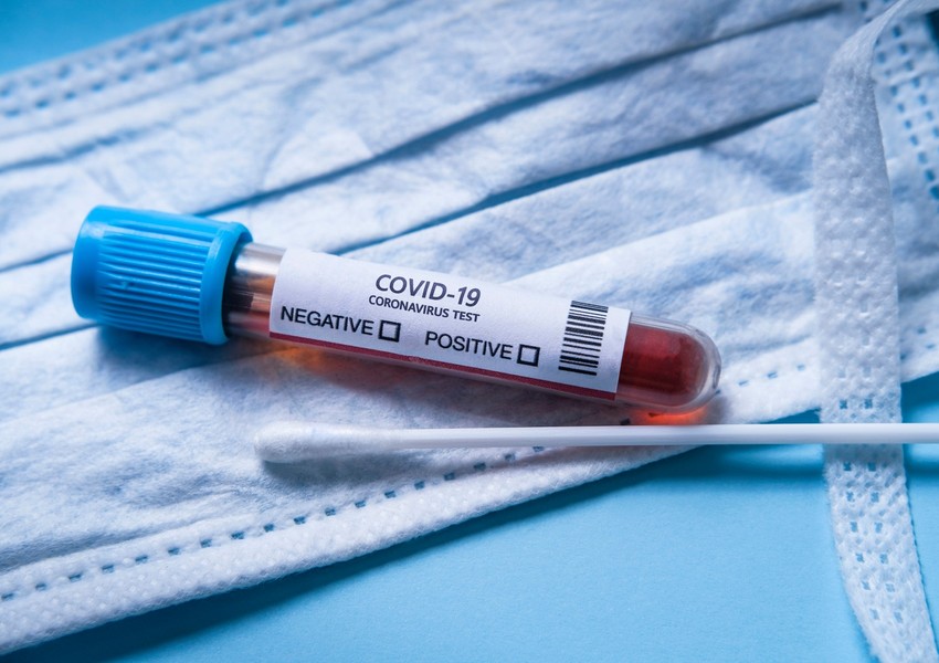 SON DƏQİQƏ! Azərbaycanda yoluxma yenidən artdı