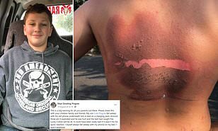 Telefonu şarja qoyub yuxuya gedən yeniyetmə BELƏ YANDI - FOTO+18