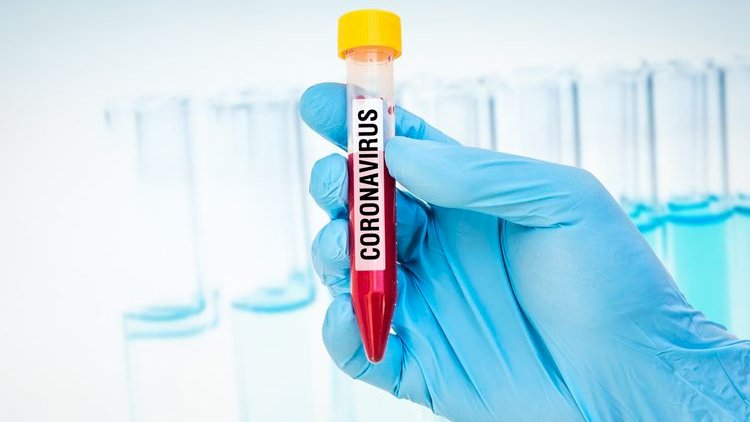 İranda bir gündə 117 nəfər koronavirusdan öldü