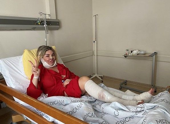 Kişi özünü “Barbi”yə oxşatmaq üçün əməliyyat keçirdi - FOTO