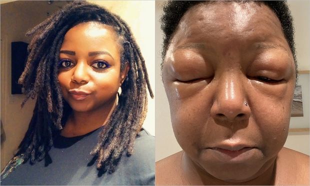 Ev şəraitində saçlarını boyayan qadın güzgüyə baxanda şoka düşdü - FOTO