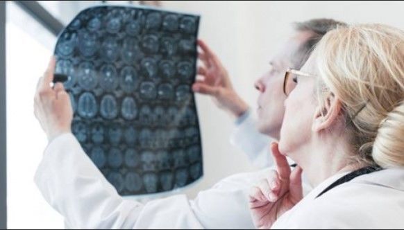 Доказан разрушительный вред коронавируса для мозга