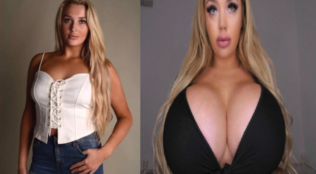 Sinəsini anormal dərəcədə böyüdüb ZƏNGİNLƏŞDİ - FOTO