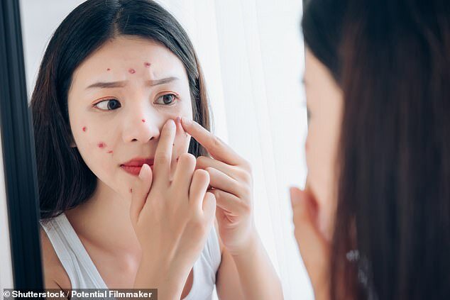 Qız burnundakı sızanağı sıxdı - XƏSTƏXANAYA DÜŞDÜ