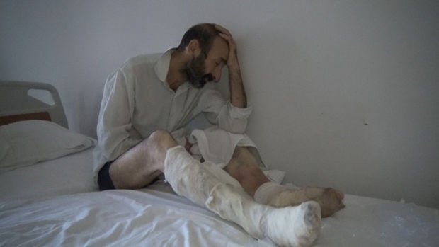 Özünü yandıran Qarabağ döyüşçüsünün fəryadı: “İstəmirəm ki, kiməsə zülm verim” - VİDEO