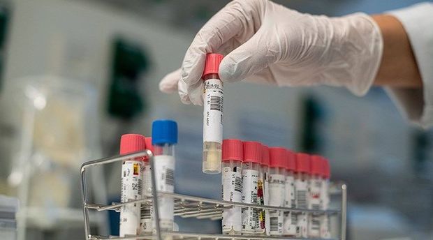 Число вылечившихся от коронавируса в мире превысило 21 млн