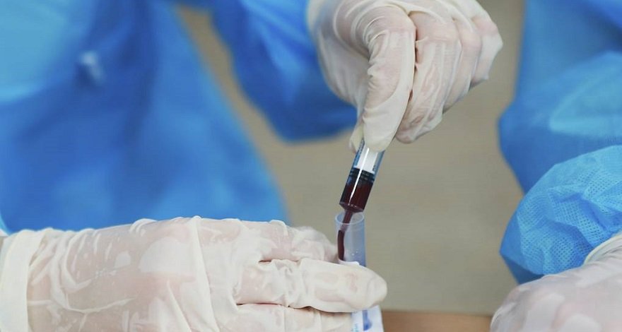 Ученые разрабатывают лекарство от коронавируса на основе антител лошадей