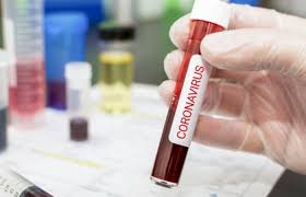 Bu gün Azərbaycanda neçə nəfər koronavirusa yoluxdu? - RƏSMİ