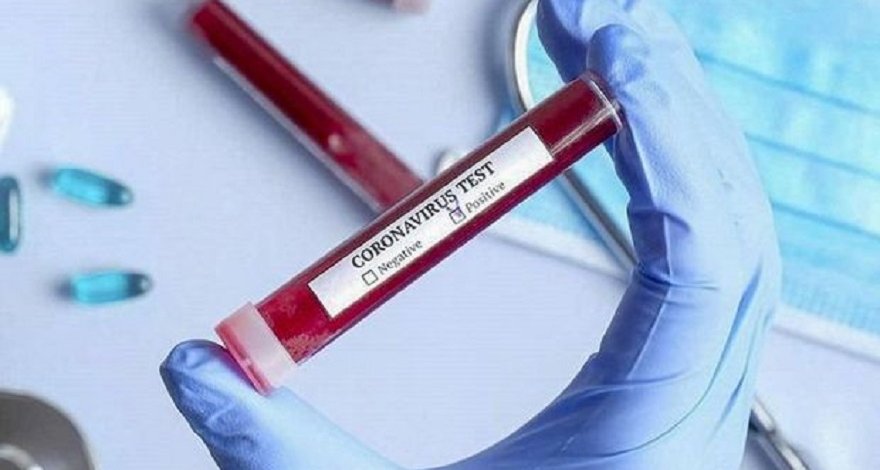 Шекинский рынок, где выявлено массовое заражение COVID-19, закрыли на трое суток