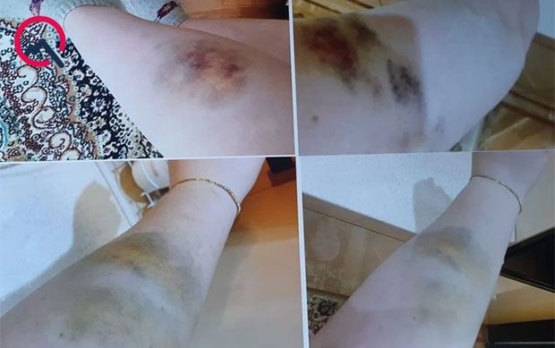 “Ərim məni dəfələrlə döysə də, polis olduğu üçün cinayət işi açılmır”