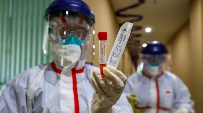 Azərbaycanda koronavirusun ən çox yayıldığı bölgələr açıqlanıb