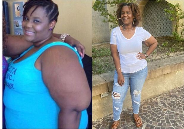 64 kiloqram arıqlayan qadın uğurunun sirrini bölüşdü - FOTO