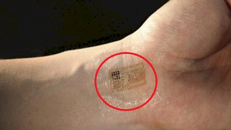Azərbaycanda insanlar çipləşəcək? – TƏBİB-dən açıqlama + Video