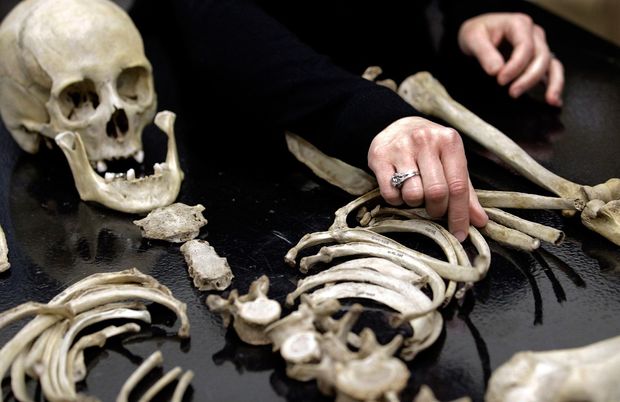 Cərrah gizli şəkildə insan sümüklərindən kolleksiya toplayıb