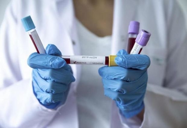 Azərbaycanda daha iki nəfər koronavirusdan öldü: 80 yeni yoluxma - FOTO