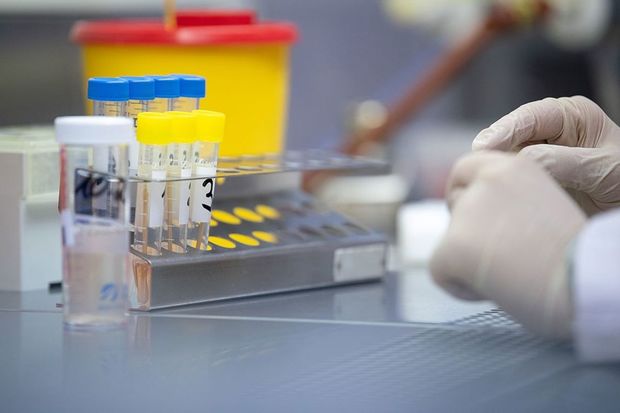 Назван фактор, ослабляющий иммунитет к коронавирусу