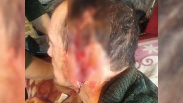 Ağ ayının hücumuna məruz qalan kişi sağ qaldı