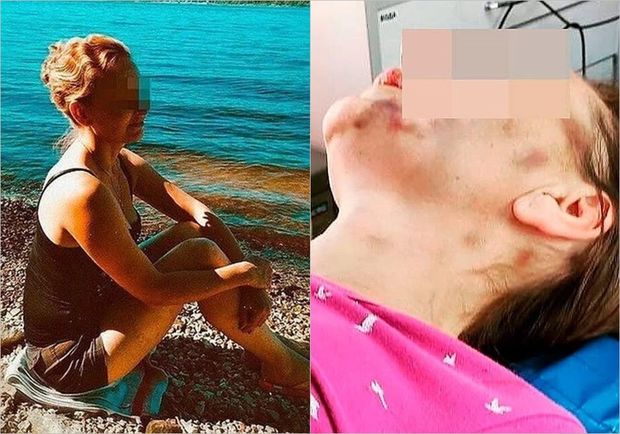 Boşanmaq istəyən arvadını evə bağlayıb, bir ay ac saxladı - FOTO/VİDEO