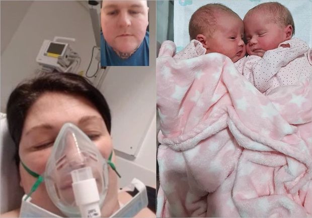 Koronavirusa görə komaya düşən hamilə qadın əkiz uşaqlar dünyaya gətirdi - FOTO