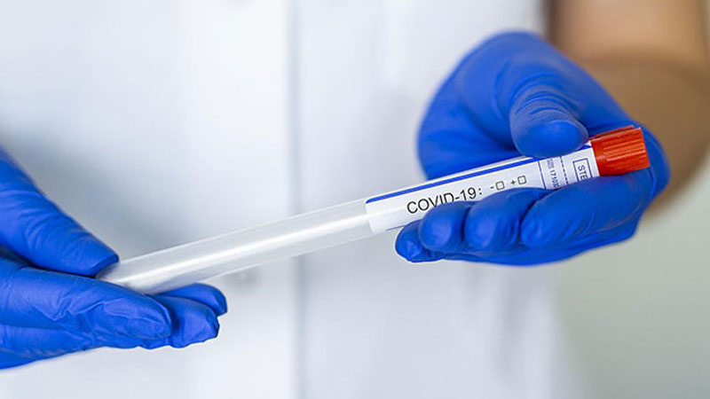 Koronavirusa yoluxanların sayı 530-a çatdı - GÜNÜN STATİSTİKASI