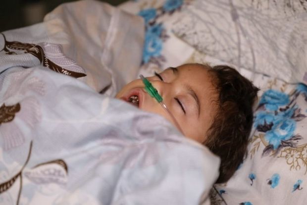 Bərdənin raket atəşinə tutulması nəticəsində yaralananlardan dördü azyaşlıdır - FOTO