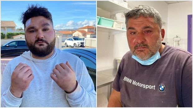 Ermənilərin Fransada hücum etdikləri türkiyəli: “Yaxınlıqda olan Fransa polisi müdaxilə etmədi” - FOTO