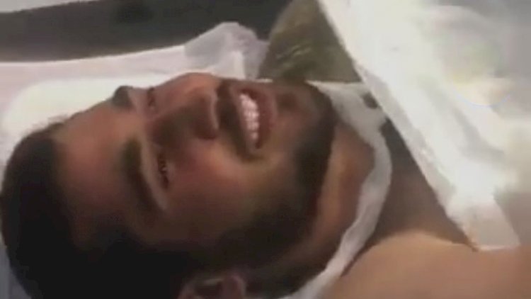 Yaralı əsgər əməliyyat masasında “Qarabağ” oxudu - Video