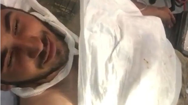 Раненый азербайджанский солдат спел песню о Карабахе - ВИДЕО