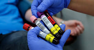 Koronavirusu 10 dəqiqəyə öldürən vasitə - Azərbaycanda bitir