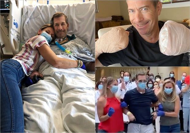 Мужчина заболел коронавирусом и лишился пальцев - ФОТО/ВИДЕО