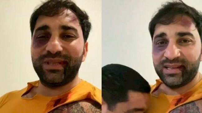 Kamil Zeynallı ermənilərə əsir düşüb?-VİDEO