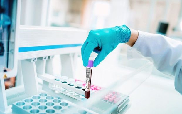 Сотрудница TƏBİB заразилась коронавирусом