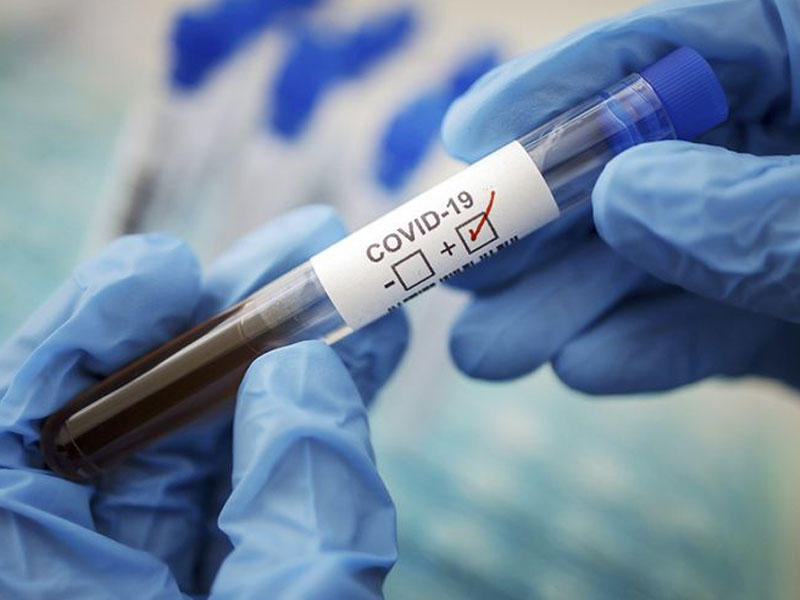 Gürcüstanda 101 yaşlı qadın koronavirusdan sağalıb