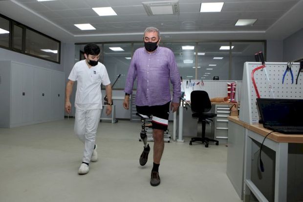 Azərbaycanda hazırlanmış ilk yüksək texnologiyalı protezlər təqdim edildi - FOTO