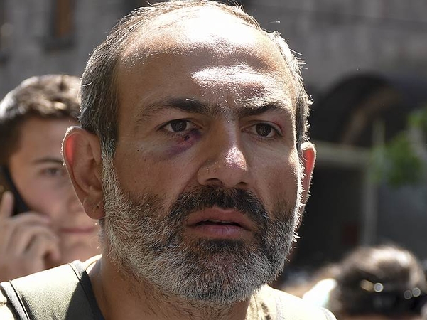 SON DƏQİQƏ: Ermənistanda nə baş verir? ORDU HAZIRLIQ VƏZİYYƏTİNƏ GƏTİRİLDİ