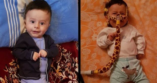 Маленькому Тунару необходима срочная помощь - ФОТО/ВИДЕО