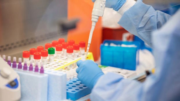 Azərbaycanda daha 40 nəfər koronavirusdan öldü: 1850 yeni yoluxma - FOTO