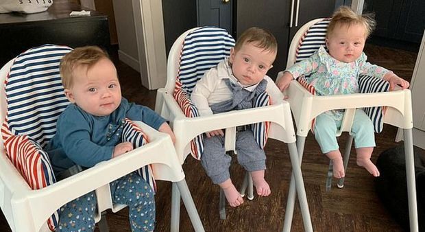 Tibbdə qeyri-adi hadisə: İki bətni olan qadın üçəm dünyaya gətirdi - FOTO