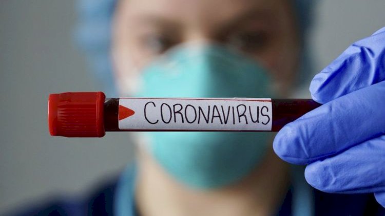 Gürcüstanda son sutkada koronavirusdan 25 nəfər ölüb