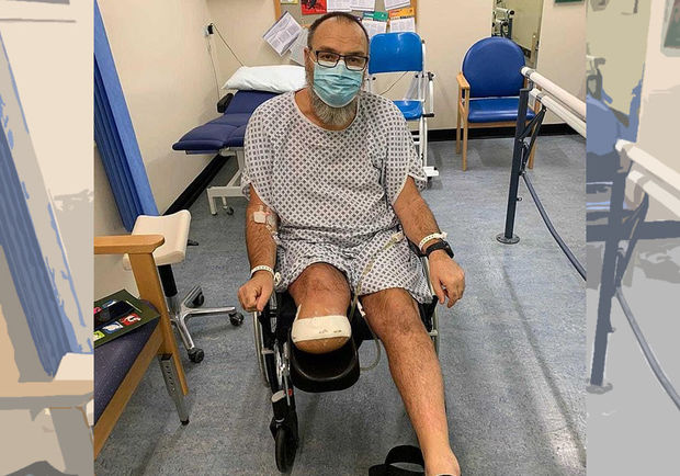 Sağlam kişi koronavirusa yoluxduqdan sonra ayağını itirdi - FOTO