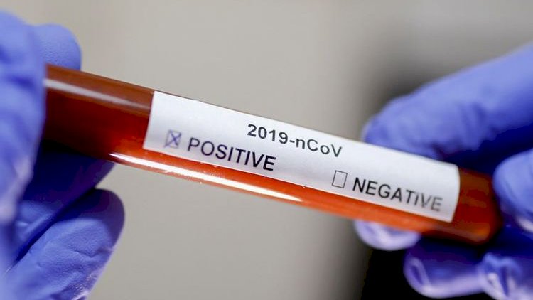 Gürcüstanda son sutkada koronavirusdan 21 nəfər ölüb