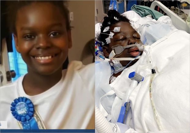 Ребенку придется ампутировать ноги из-за осложнения после COVID-19